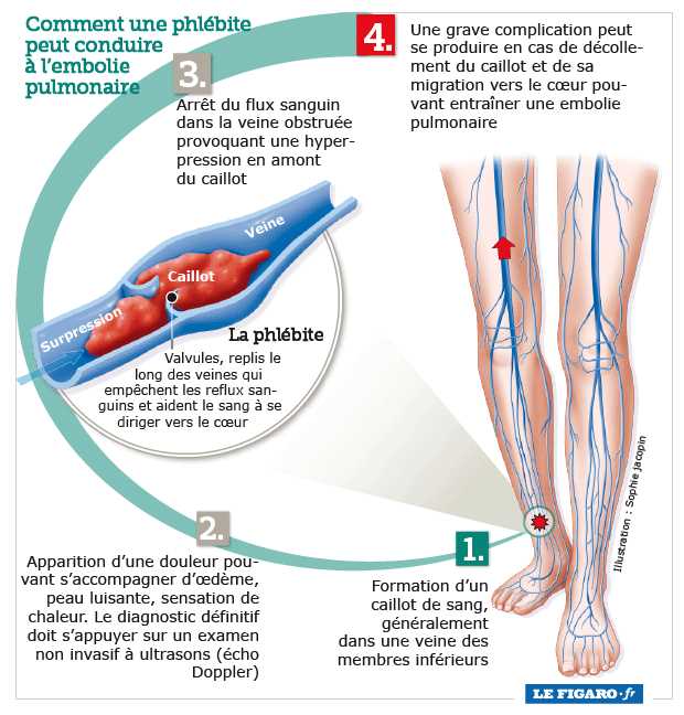 Comment prévenir les problèmes de santé chez les azalées