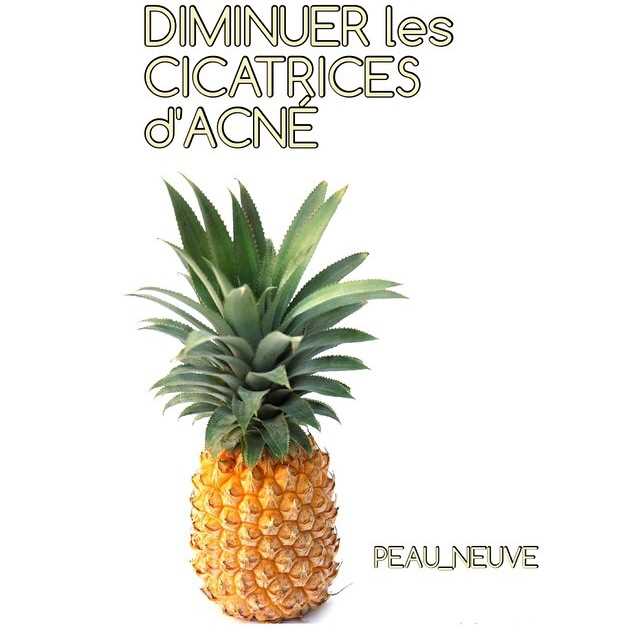 Choix d'un ananas mûr